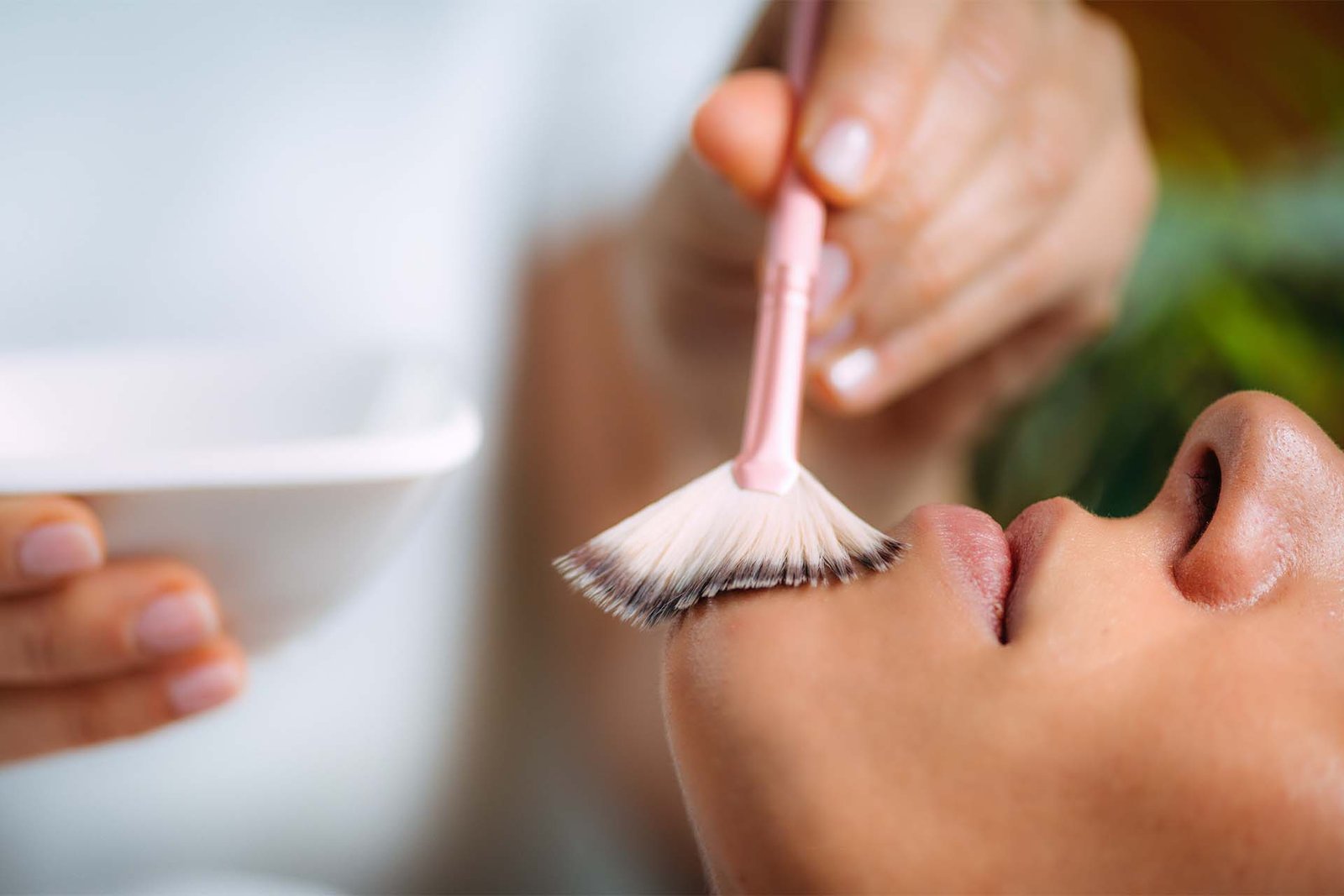 Chemical Peels