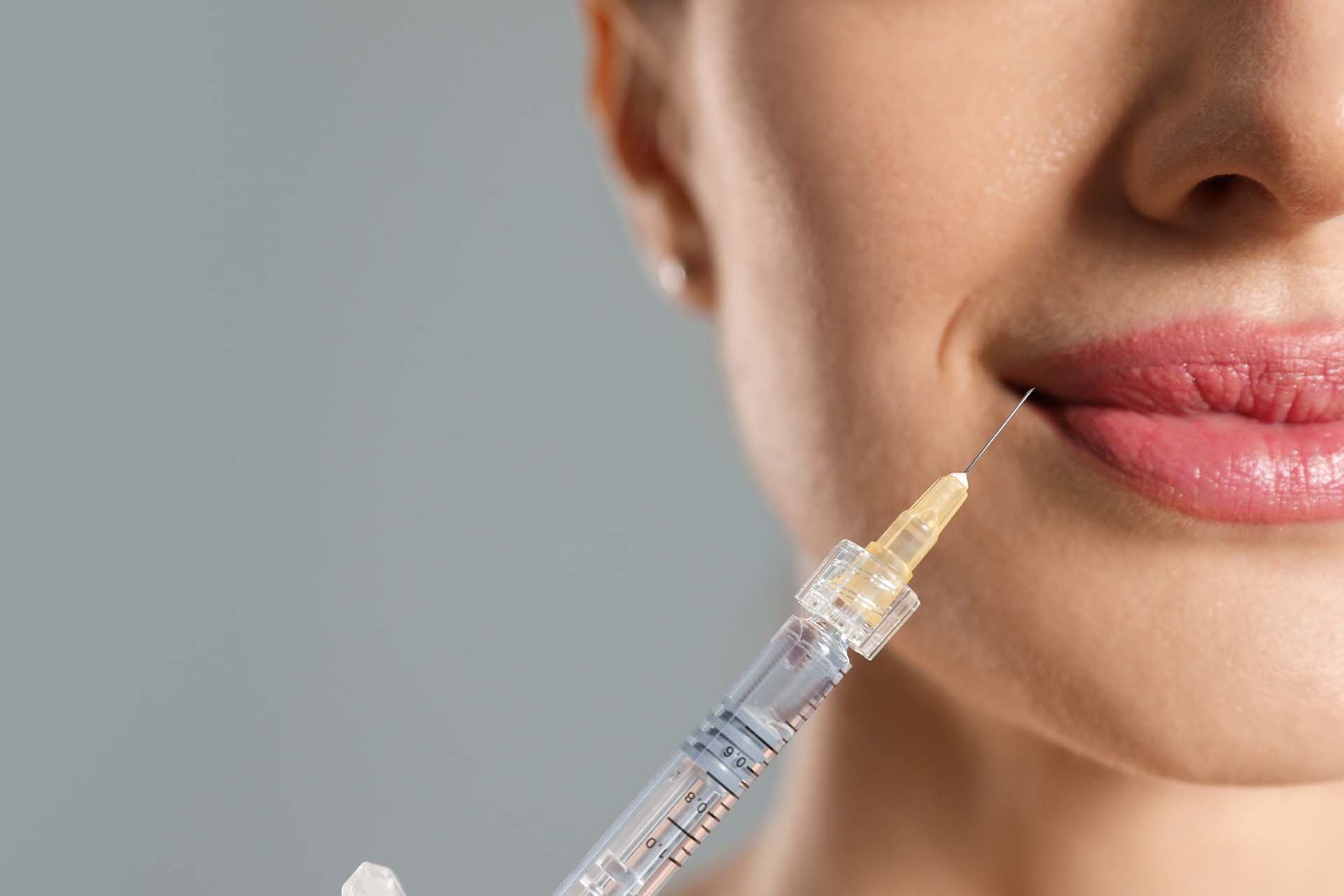 Dermal Fillers