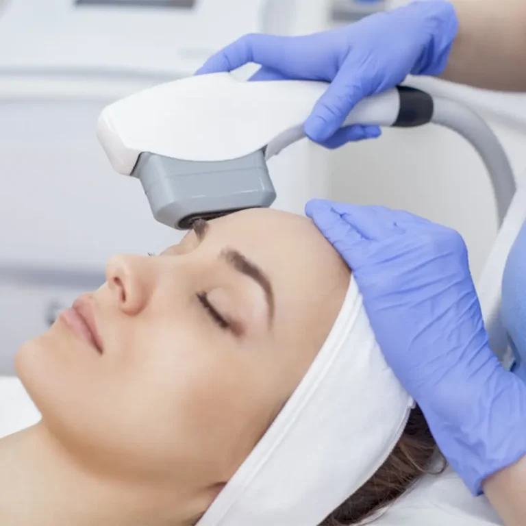 IPL Facial 2